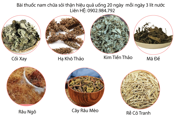 chữa sỏi thận bằng thuốc nam