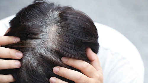 Cao hà thủ ô mẫu mới trị bạc tóc