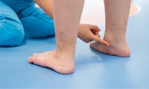 Thăm khám ở trung tâm y tế để ngăn chặn biến chứng