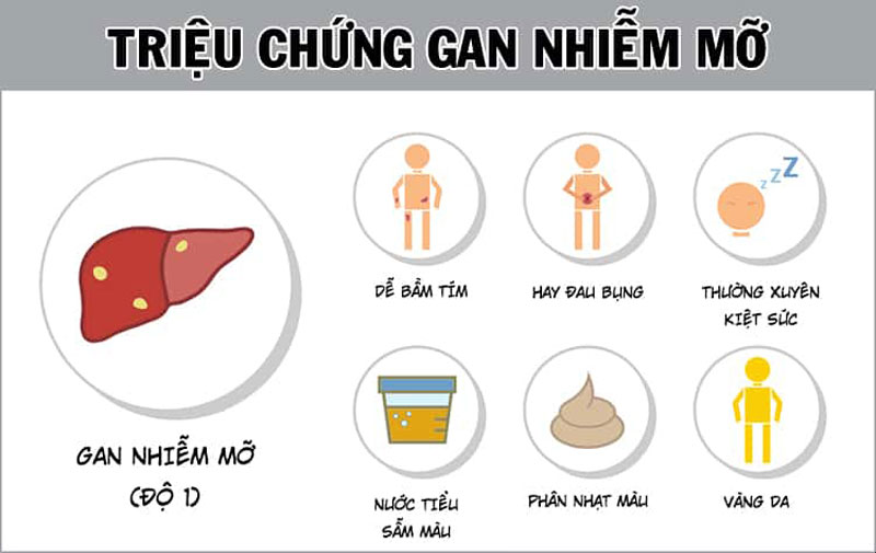 Những triệu chứng của gan thường gặp