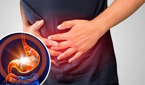 Thuốc bắc trị rối loạn tiêu hóa