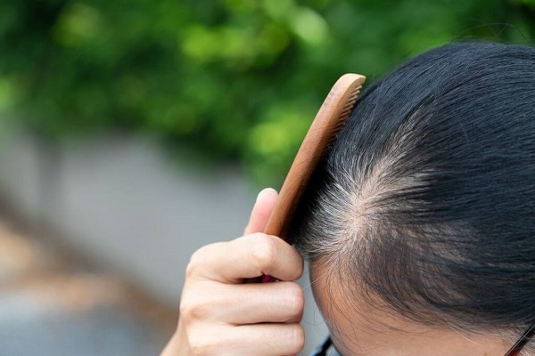Tóc bạc sớm do những nguyên nhân nào