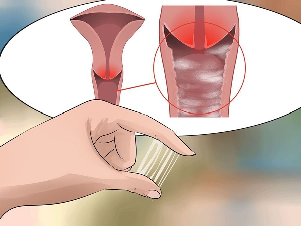 Giảm khí hư nhờ sinh hoạt hằng ngày