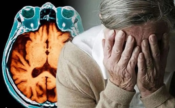 Cải thiện chứng đãng trí nhờ hạt móc mèo