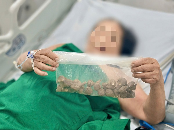 Củ ấu tàu gây ngộ độc