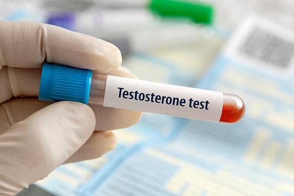 Nam giới dư thừa testosterone
