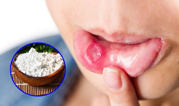 Giảm nóng trong nhờ bột sắn